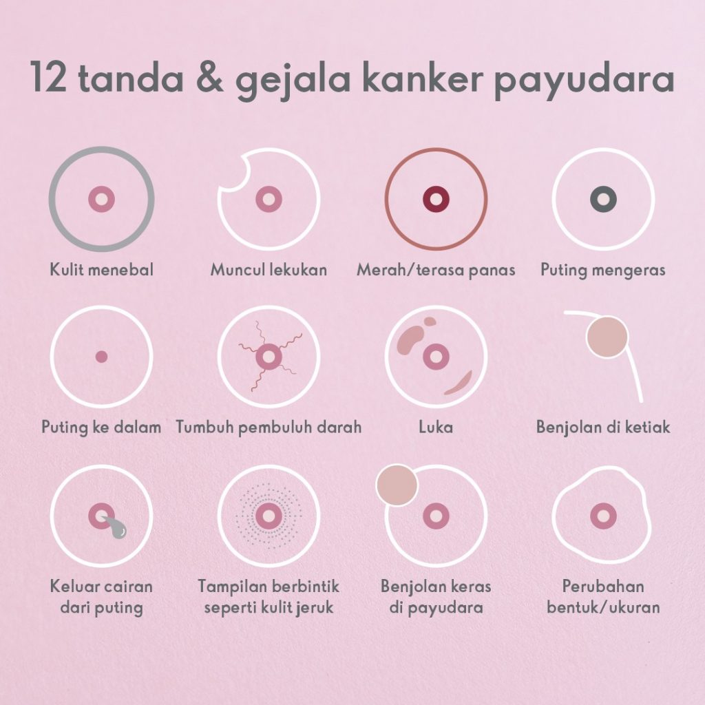 Peduli Kanker Payudara Kenali 12 Ciri Dan Tanda tandanya